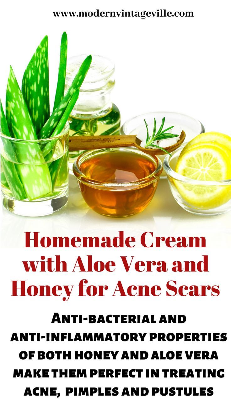 honey and aloe vera benefits